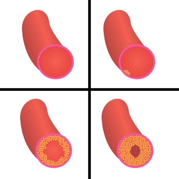 Regulating blood lipids Regulating blood lipids